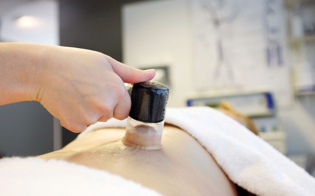 Unleash Relief: Explore Cupping Therapy Massagers in Westford, MA