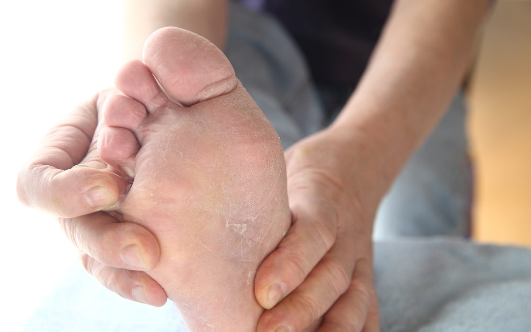 Find Lasting Relief with Bunion Treatment in Norfolk, VA, for Healthier Feet