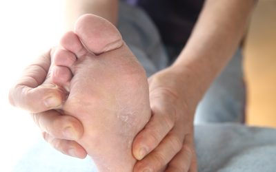 Find Lasting Relief with Bunion Treatment in Norfolk, VA, for Healthier Feet