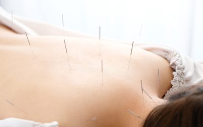 Find Holistic Wellness Education Through Acupuncture Courses Dallas Has Available Now