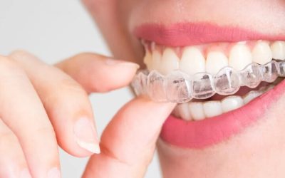 How Restorative Dentistry Burlington NC, Can Transform Your Smile and Oral Health?