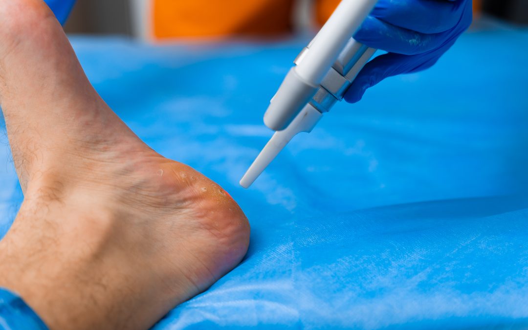 Regain Your Step with Effective Heel Pain Treatment Fulshear, TX Residents Choose